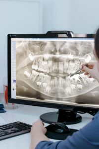 Close-Up Shot of a Person Pointing at the Xray Image on the Computer Screen